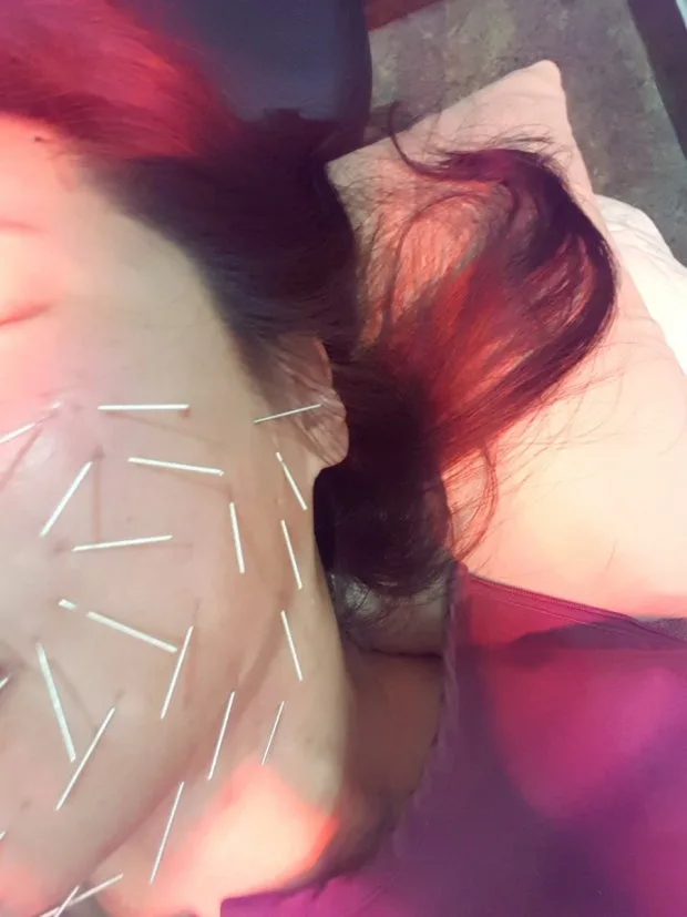 얼굴의 한쪽에 갑작스러운 강한 통증이 발생 — 이미지 2